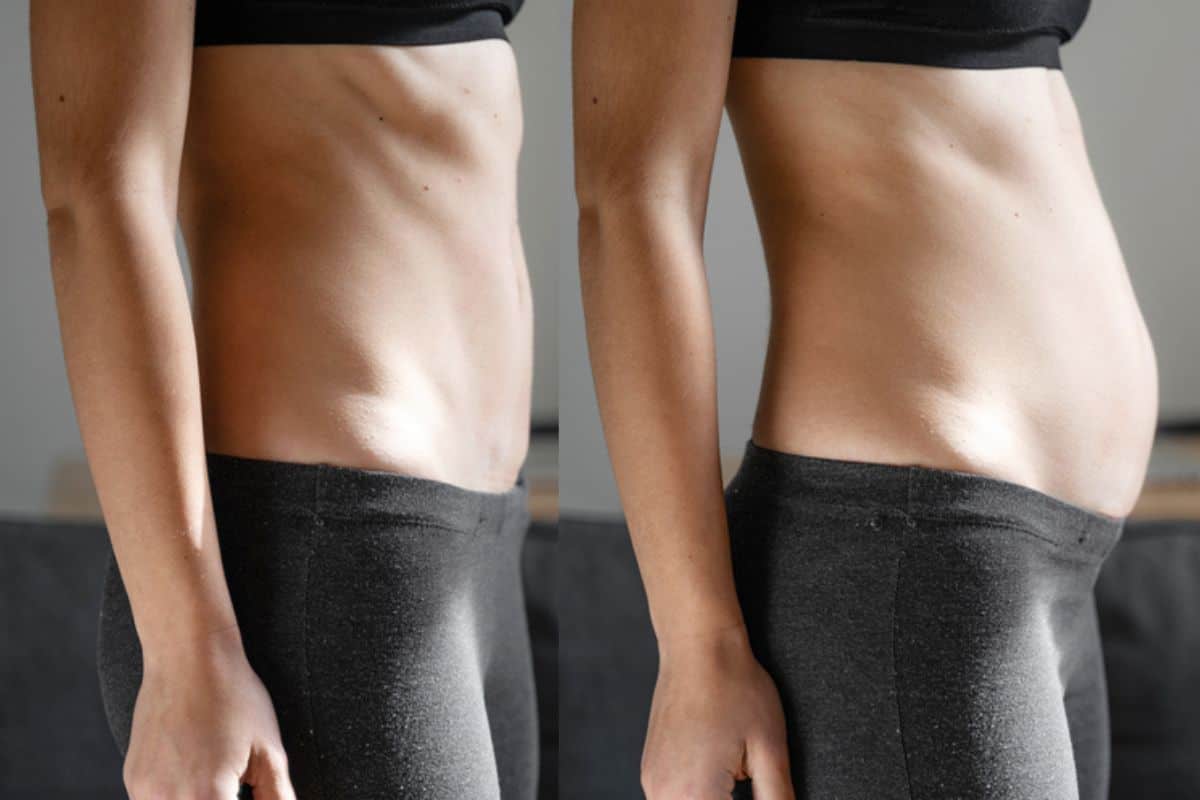 How long does diastasis recti take to improve Shoreham Beach?