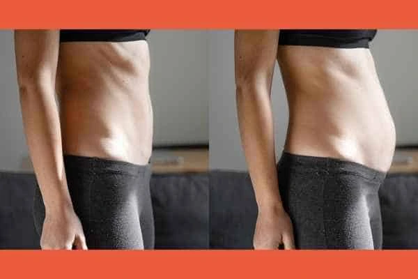 LA-EMS Body Sculpting results Shoreham Beach